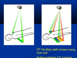 CT 1 lôùp caét ( 1 haøng
ñaàu doø/Single row CT)
CT ña lôùp caét (nhieàu haøng
ñaàu doø
 