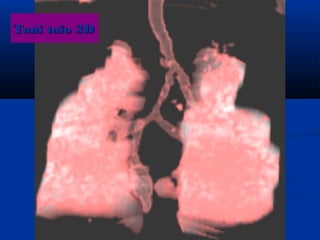 Taùi taïo 3DTaùi taïo 3D
 