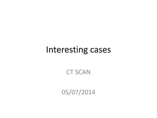 Interesting cases
CT SCAN
05/07/2014
 