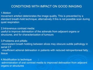 CT scan ABDOMEN Explained توضیحات سی تی اسکن شکم ولگن.ppt