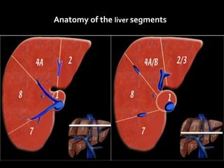 Anatomy of the liver segments
 