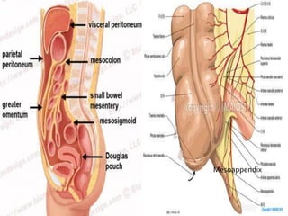 Mesoappendix
 
