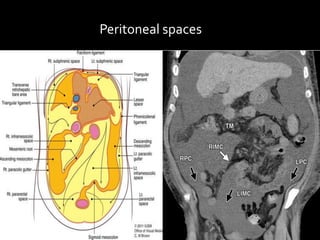 Peritoneal spaces
 