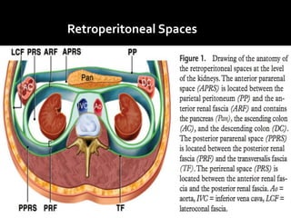 Retroperitoneal Spaces
 