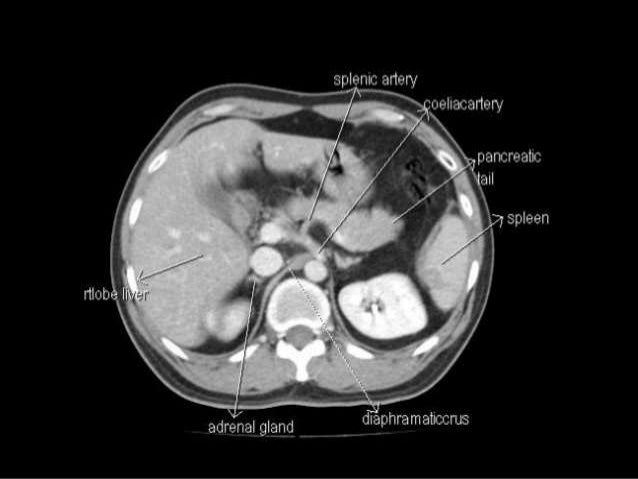 Guide To Ct Scan