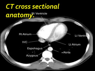CT cross sectional
anatomy.
 