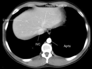 Ct abdominal ………………………………………………………...pdf