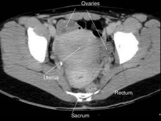 Ct abdominal ………………………………………………………...pdf