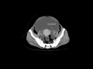 Ct abdominal ………………………………………………………...pdf