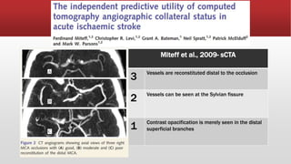 Ccta Rector Score CTA Collateral Scoring system- RADIOLOGY 2 | PPTX