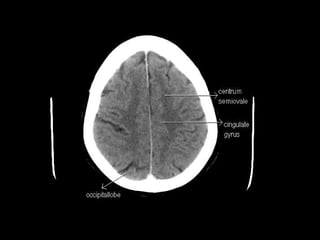 CT Anatomy | PPT