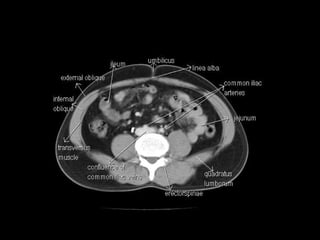 CT Anatomy | PPT