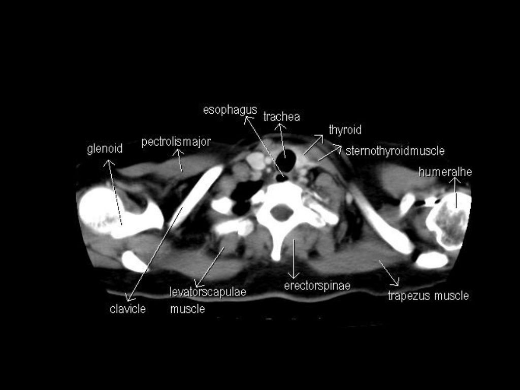 CT Anatomy