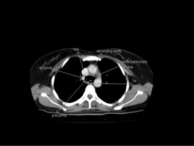 CT Anatomy Biology Diagrams