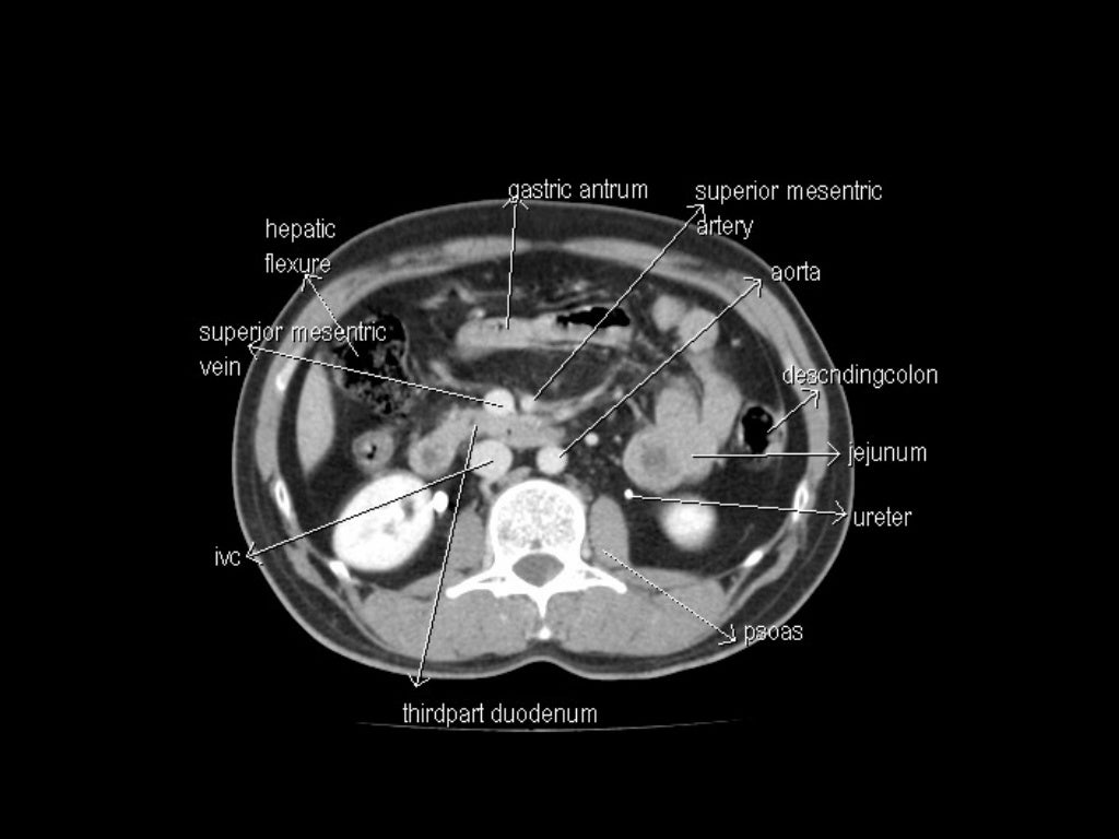CT Anatomy Biology Diagrams