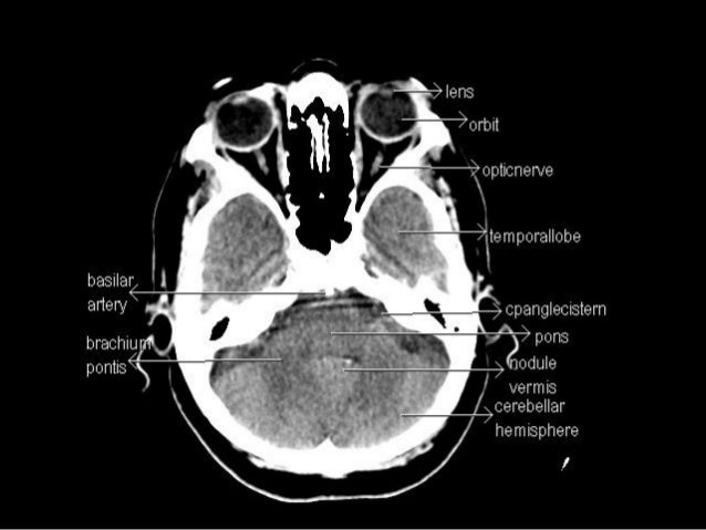Ct anatomy