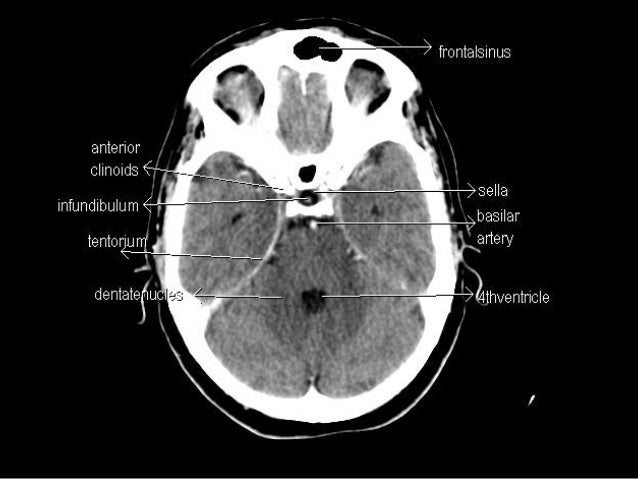 Ct anatomy