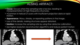 CT AND MRI ARTIFACTS CASUES AND APPERENCES.pptx