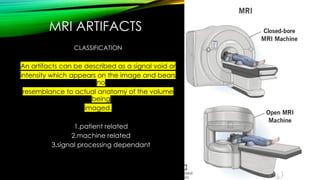 Artifact Classification System CT AND MRI ARTIFACTS CASUES AND APPERENCES.pptx
