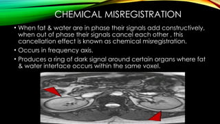 CT AND MRI ARTIFACTS CASUES AND APPERENCES.pptx