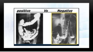 ct and mri contrast agents presentations | PPTX