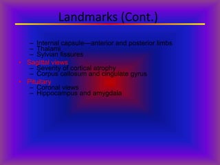 Landmarks (Cont.)
– Internal capsule—anterior and posterior limbs
– Thalami
– Sylvian fissures
• Sagittal views
– Severity of cortical atrophy
– Corpus callosum and cingulate gyrus
• Pituitary
– Coronal views
– Hippocampus and amygdala
 