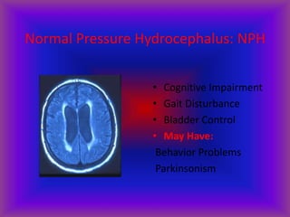 Normal Pressure Hydrocephalus: NPH
• Cognitive Impairment
• Gait Disturbance
• Bladder Control
• May Have:
Behavior Problems
Parkinsonism
 