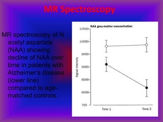 MR Spectroscopy
MR spectroscopy of N
acetyl aspartate
(NAA) showing
decline of NAA over
time in patients with
Alzheimer’s disease
(lower line)
compared to age-
matched controls.
 