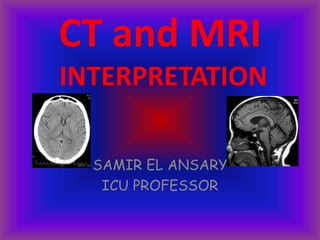 CT and MRI
INTERPRETATION
SAMIR EL ANSARY
ICU PROFESSOR
 