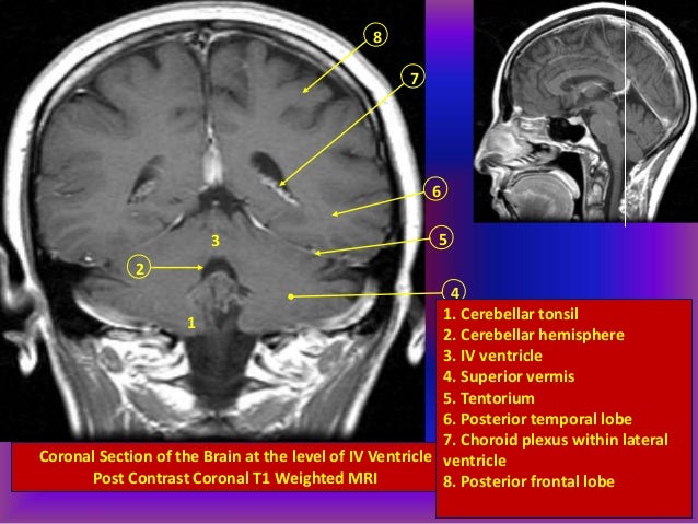 Ct and mri interpretation