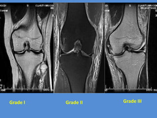 Grade Radiology Ct and mri,ppt | PPTX