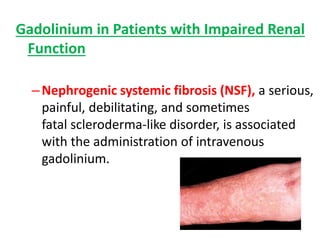 Gadolinium in Patients with Impaired Renal
Function
–Nephrogenic systemic fibrosis (NSF), a serious,
painful, debilitating, and sometimes
fatal scleroderma-like disorder, is associated
with the administration of intravenous
gadolinium.
 