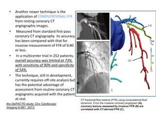 • Another newer technique is the
application of COMPUTATIONAL FFR
from resting coronary CT
angiographic images.
• Measured from standard first-pass
coronary CT angiography its accuracy
has been compared with that for
invasive measurement of FFR of 0.80
or less.
• In a multicenter trial in 252 patients,
overall accuracy was limited at 73%,
with sensitivity of 90% and specificity
of 54%.
• The technique, still in development,
currently requires off-site analysis but
has the potential advantage of
assessment from routine coronary CT
angiograms acquired with the patient
at rest. CT fractional flow reserve (FFR) using computational fluid
dynamics. From the invasive coronary angiogram (A),
coronary lesions assessed by invasive FFR (B) are
correlated with CT-derived FFR (C).
the DeFACTO study. Circ Cardiovasc
Imaging 6:881, 2013.
 