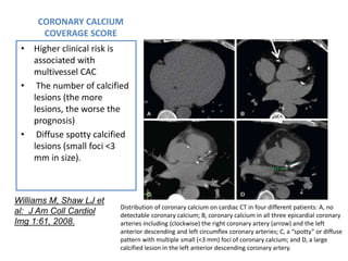 CORONARY CALCIUM
COVERAGE SCORE
• Higher clinical risk is
associated with
multivessel CAC
• The number of calcified
lesions (the more
lesions, the worse the
prognosis)
• Diffuse spotty calcified
lesions (small foci <3
mm in size).
Distribution of coronary calcium on cardiac CT in four different patients: A, no
detectable coronary calcium; B, coronary calcium in all three epicardial coronary
arteries including (clockwise) the right coronary artery (arrow) and the left
anterior descending and left circumflex coronary arteries; C, a “spotty” or diffuse
pattern with multiple small (<3 mm) foci of coronary calcium; and D, a large
calcified lesion in the left anterior descending coronary artery.
Williams M, Shaw LJ et
al: J Am Coll Cardiol
Img 1:61, 2008.
 