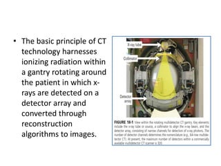 • The basic principle of CT
technology harnesses
ionizing radiation within
a gantry rotating around
the patient in which x-
rays are detected on a
detector array and
converted through
reconstruction
algorithms to images.
 