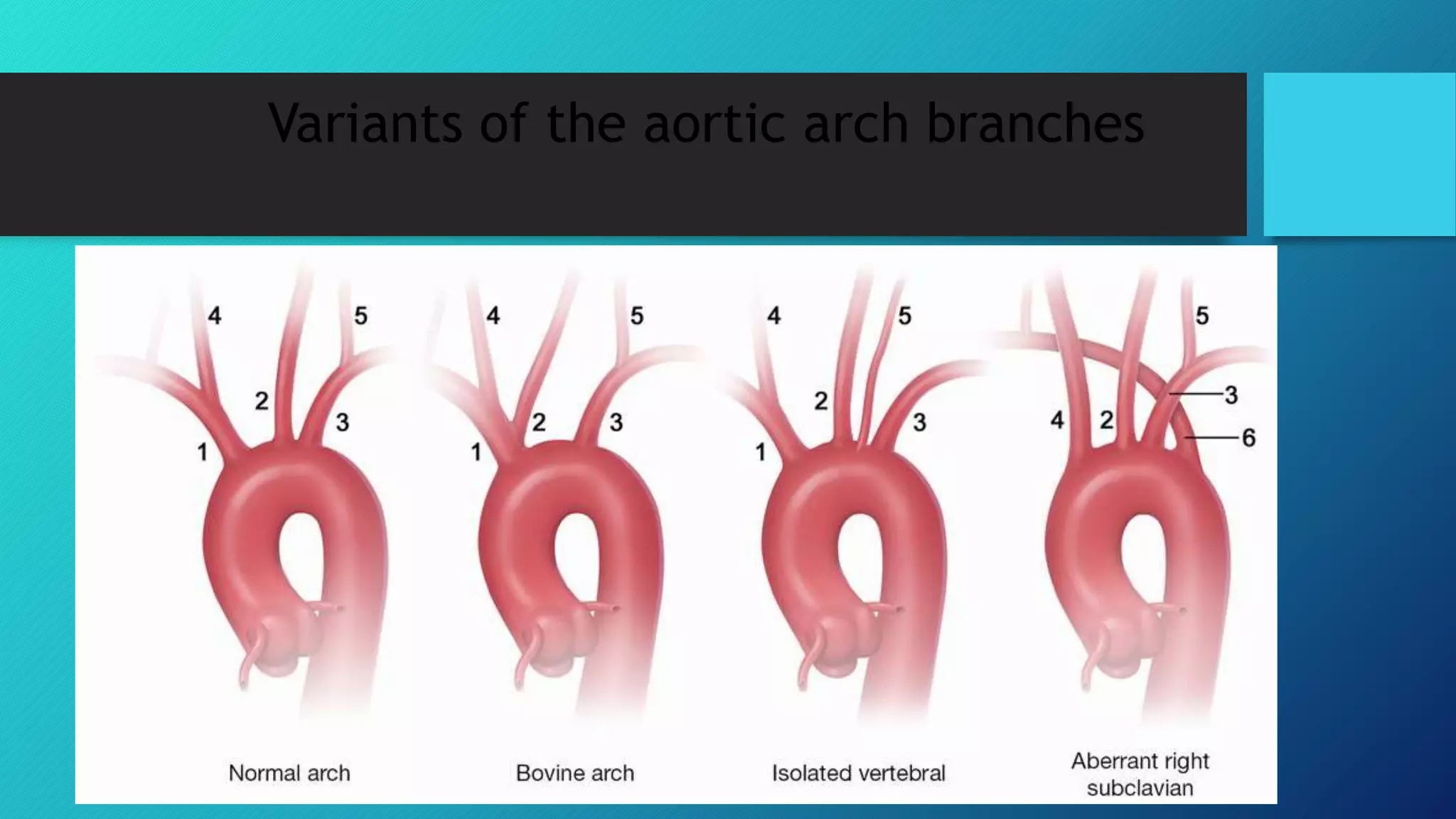 CT Angiography.pptx