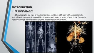 ct angiography and pre and post scans by WAQAS MAHMOOD RIT 6TH SEMESTER ...
