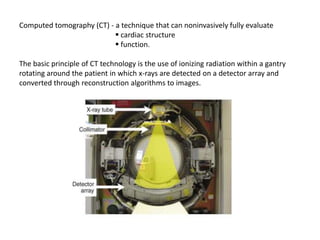 Computed tomography (CT) - a technique that can noninvasively fully evaluate
                            cardiac structure
                            function.

The basic principle of CT technology is the use of ionizing radiation within a gantry
rotating around the patient in which x-rays are detected on a detector array and
converted through reconstruction algorithms to images.
 