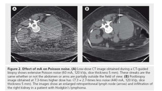 DIFFERENT TYPES OF RADIOGRAPHY CT_ARTIFACTS | PPTX