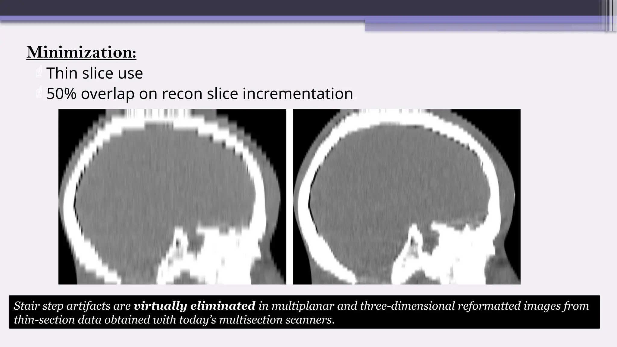 Minimization:
Thin slice use
50% overlap on recon slice incrementation.
Stair step artifacts are virtually eliminated in multiplanar and three-dimensional reformatted images from
thin-section data obtained with today’s multisection scanners.
 