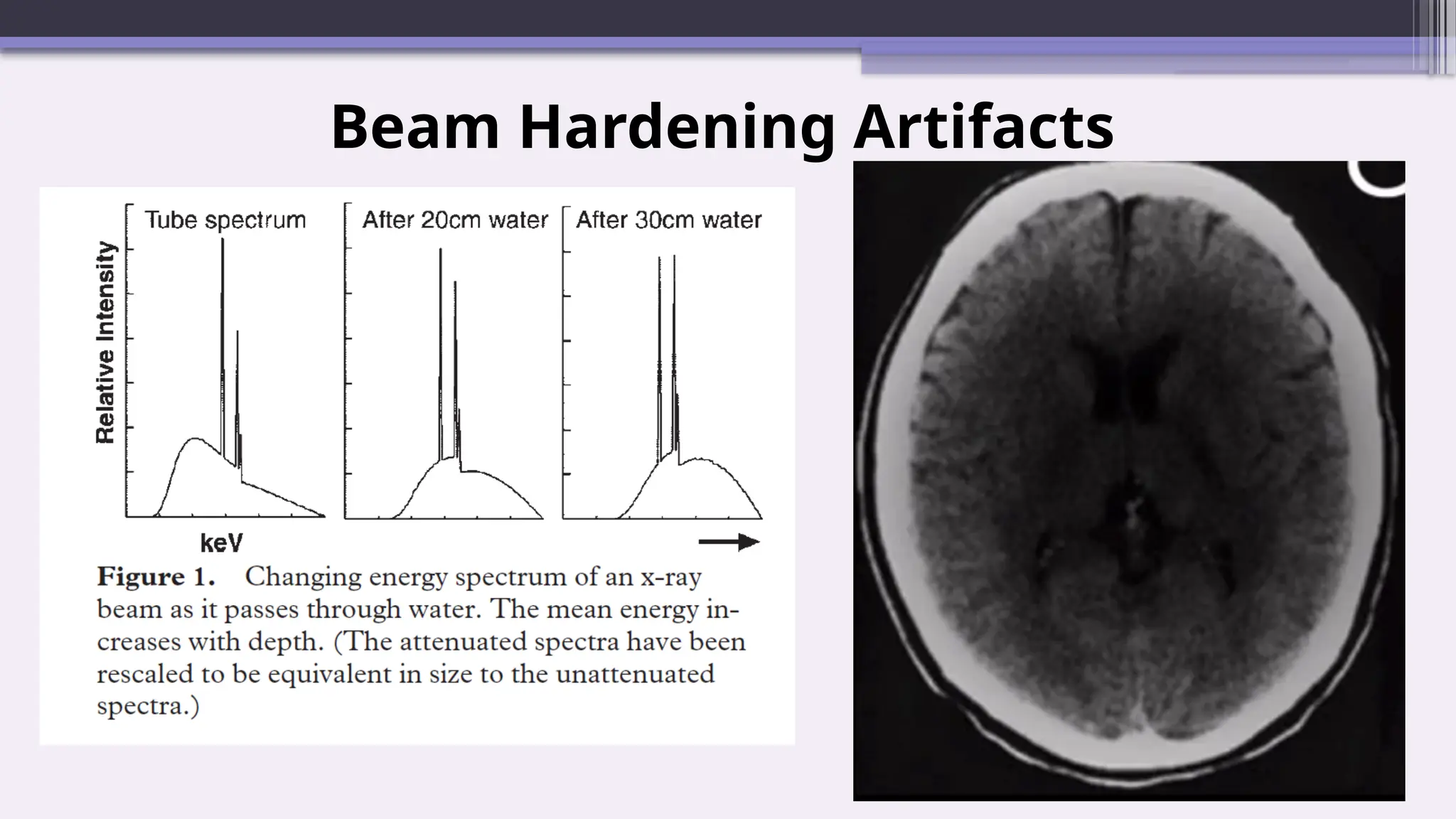 Beam Hardening Artifacts
 