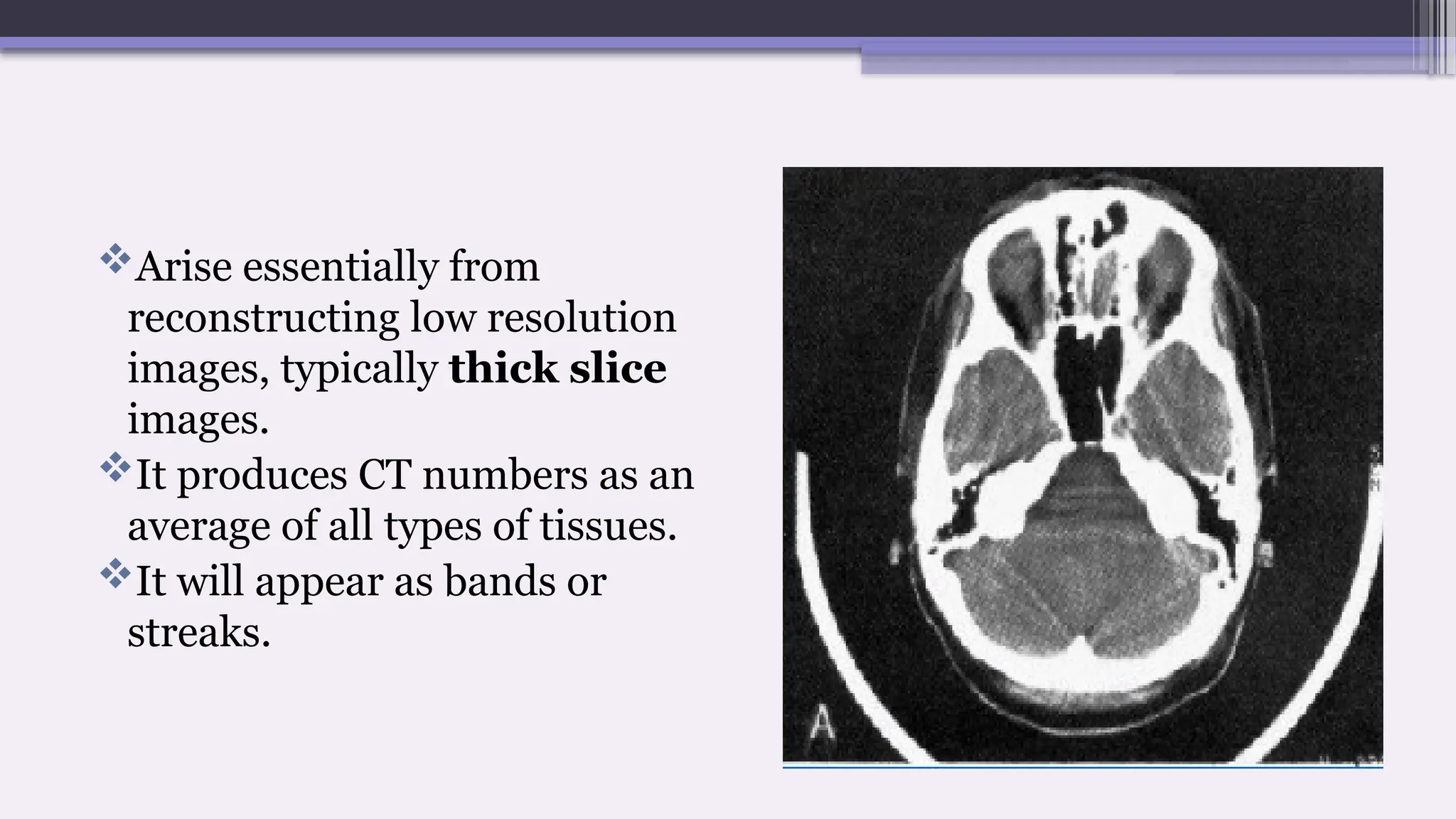 Arise essentially from
reconstructing low resolution
images, typically thick slice
images.
It produces CT numbers as an
average of all types of tissues.
It will appear as bands or
streaks.
 