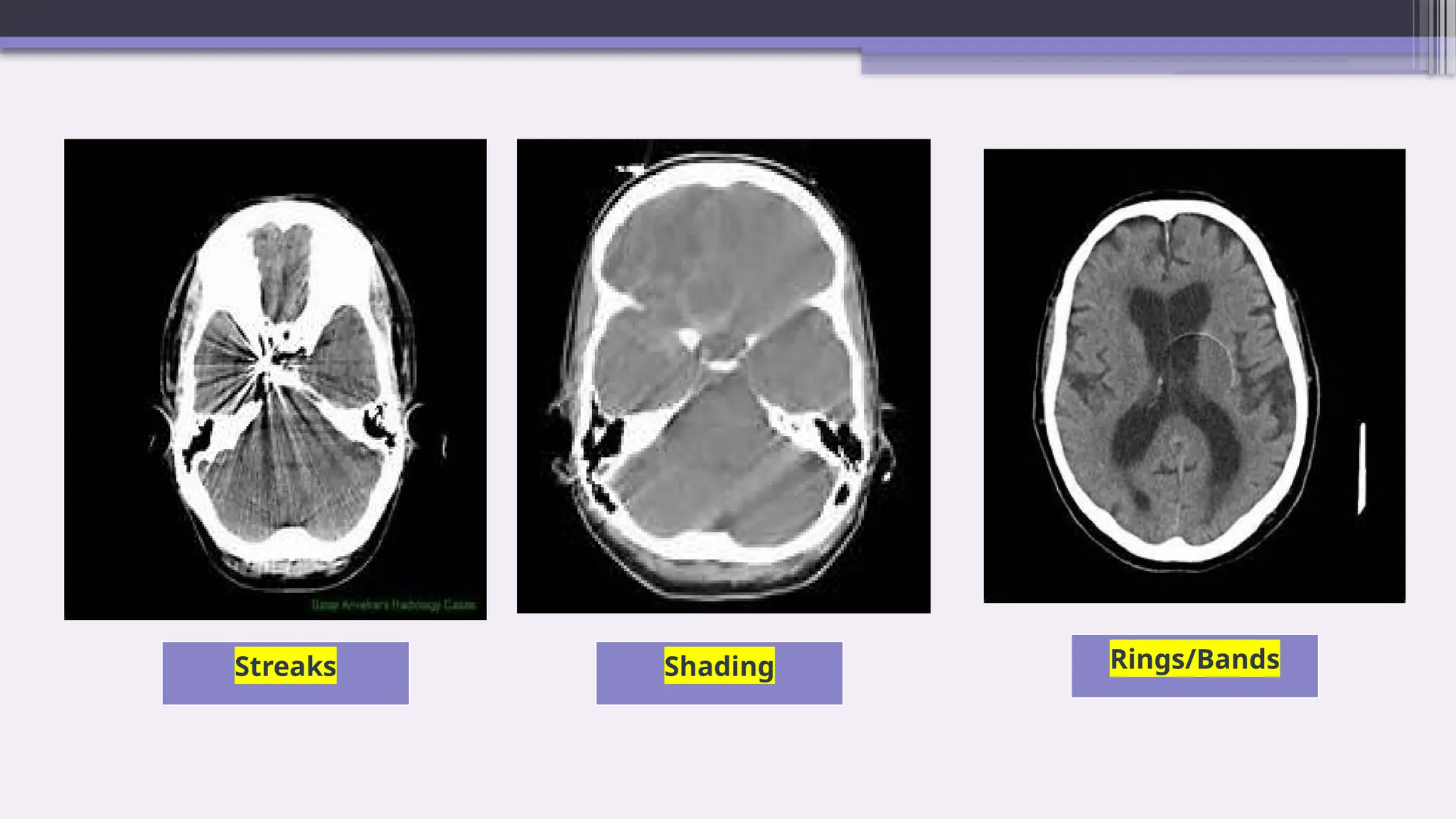 Contd..
Streaks Shading Rings/Bands
 