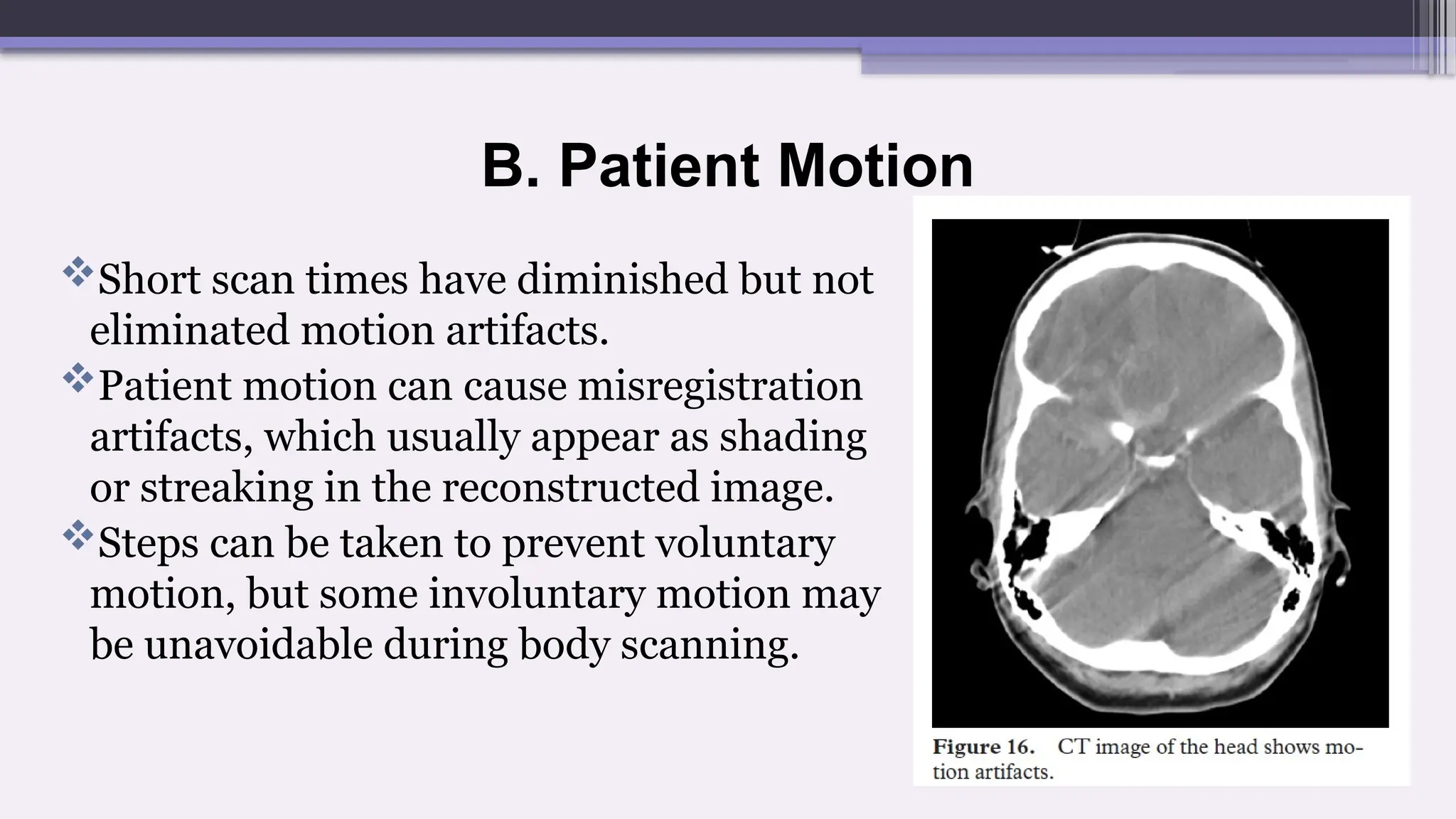 B. Patient Motion
Short scan times have diminished but not
eliminated motion artifacts.
Patient motion can cause misregistration
artifacts, which usually appear as shading
or streaking in the reconstructed image.
Steps can be taken to prevent voluntary
motion, but some involuntary motion may
be unavoidable during body scanning.
 