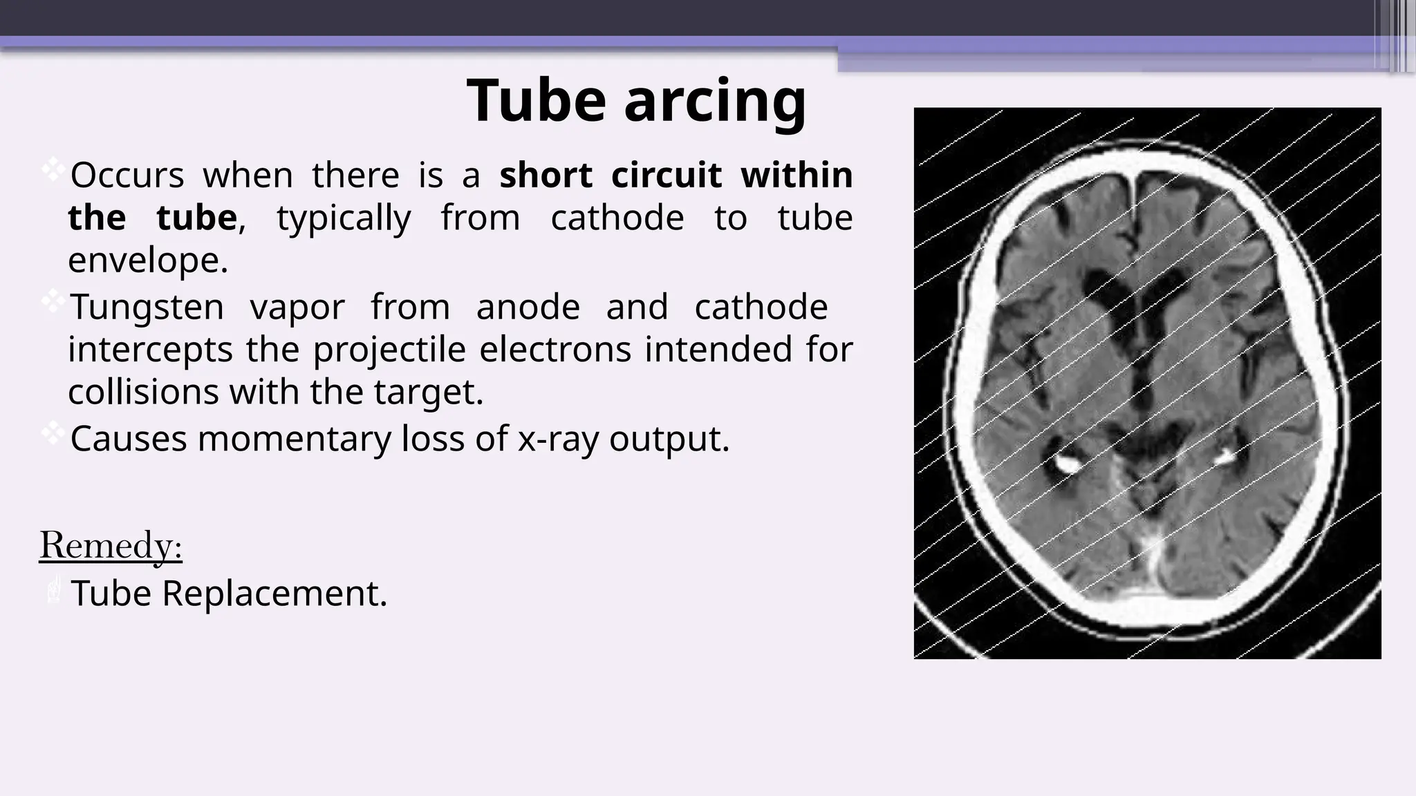 Tube arcing
Occurs when there is a short circuit within
the tube, typically from cathode to tube
envelope.
Tungsten vapor from anode and cathode
intercepts the projectile electrons intended for
collisions with the target.
Causes momentary loss of x-ray output.
Remedy:
Tube Replacement.
 