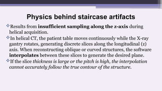 Physics behind staircase artifacts
Results from insufficient sampling along the z-axis during
helical acquisition.
In helical CT, the patient table moves continuously while the X-ray
gantry rotates, generating discrete slices along the longitudinal (z)
axis. When reconstructing oblique or curved structures, the software
interpolates between these slices to generate the desired plane.
If the slice thickness is large or the pitch is high, the interpolation
cannot accurately follow the true contour of the structure.
 