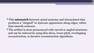 This mismatch between actual anatomy and interpolated data
produces a “stepped” or staircase appearance along edges, rather
than smooth contours.
The artifact is more pronounced with curved or angled structures
and can be reduced by using thin slices, lower pitch, overlapping
reconstruction, or iterative reconstruction algorithms.
 
