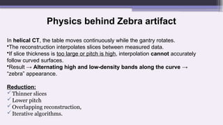 Physics behind Zebra artifact
In helical CT, the table moves continuously while the gantry rotates.
•The reconstruction interpolates slices between measured data.
•If slice thickness is too large or pitch is high, interpolation cannot accurately
follow curved surfaces.
•Result → Alternating high and low-density bands along the curve →
“zebra” appearance.
Reduction:
Thinner slices
Lower pitch
Overlapping reconstruction,
Iterative algorithms.
 