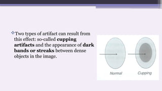 Two types of artifact can result from
this effect: so-called cupping
artifacts and the appearance of dark
bands or streaks between dense
objects in the image.
 