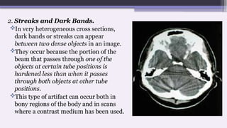 2. Streaks and Dark Bands.
In very heterogeneous cross sections,
dark bands or streaks can appear
between two dense objects in an image.
They occur because the portion of the
beam that passes through one of the
objects at certain tube positions is
hardened less than when it passes
through both objects at other tube
positions.
This type of artifact can occur both in
bony regions of the body and in scans
where a contrast medium has been used.
 